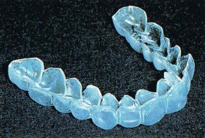 ホワイトニング