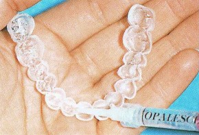 ホワイトニング