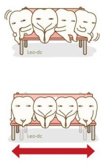 小児矯正 小児矯正