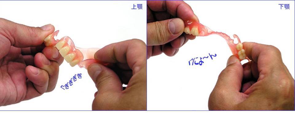 スマイルデンチャー