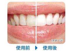 超高速振動ブラシ