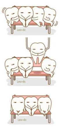 小児矯正 小児矯正