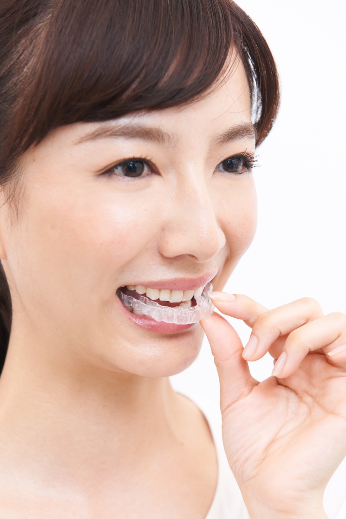 インビザライン