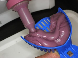 インビザライン