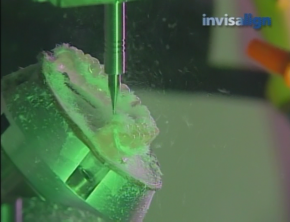 インビザライン