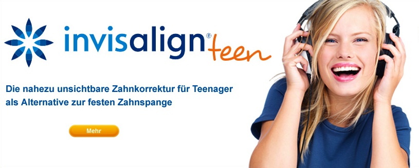 インビザライン インビザライン