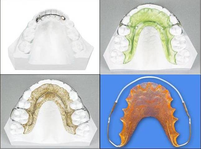 990fadc5f02884824970ae1b45cff316