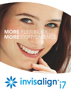 インビザラインホワイトニングサービス